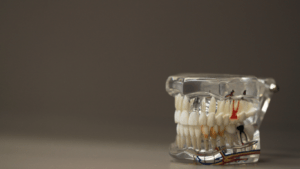 HE ROLE OF DENTAL BILLING SERVICES IN MODERN DENTISTRY